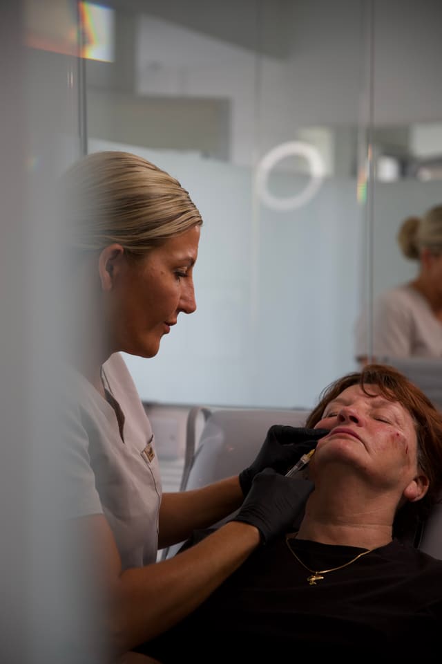 Close-up of a lip enhancement treatment
